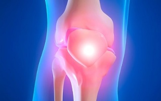 příčiny artrózy kolenního kloubu