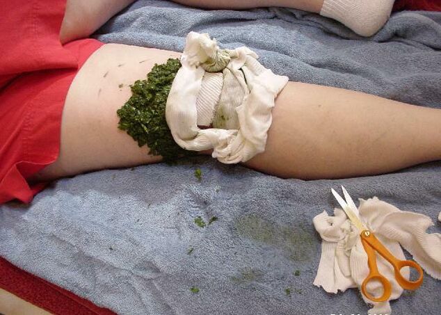 Teplý obklad z rozdrcených zelných listů na bolavý kolenní kloub s artrózou